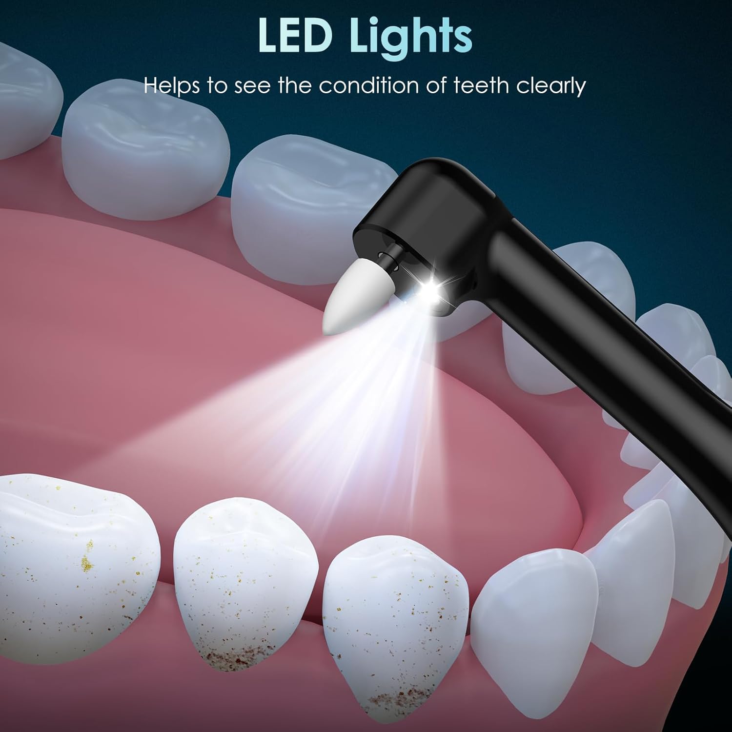 Tooth Polisher Rechargeable Te - đánh giá và giá Teeth Whitening Or Tooth Whitening