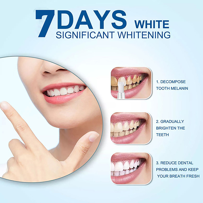 Teeth Whitening Pen Profession - đánh giá và giá Teeth Whitening Bleaching Kit