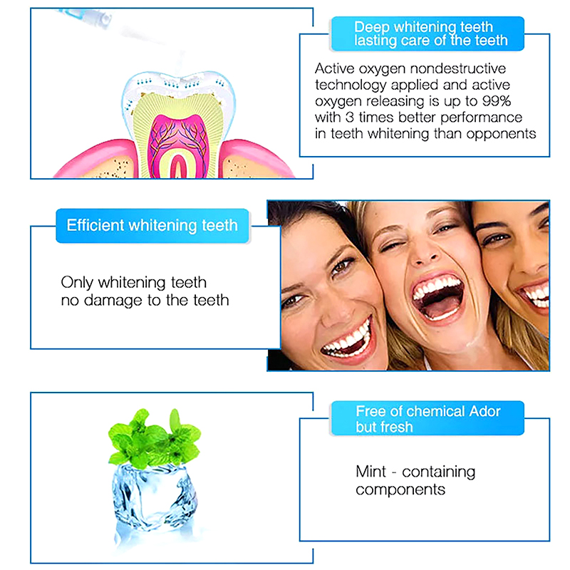 Teeth Whitening Pen Profession - đánh giá và giá Teeth Whitening Bleaching Kit
