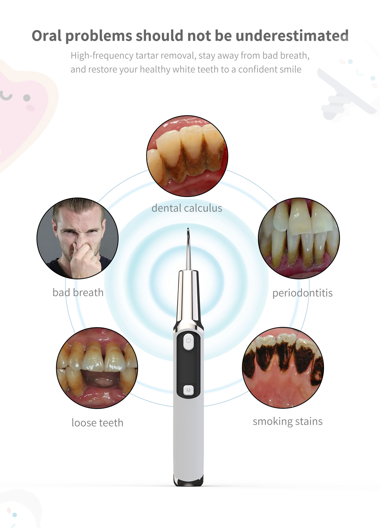 Electric Sonic Dental Calculus - đánh giá và giá Teeth Whitening Or Tooth Whitening