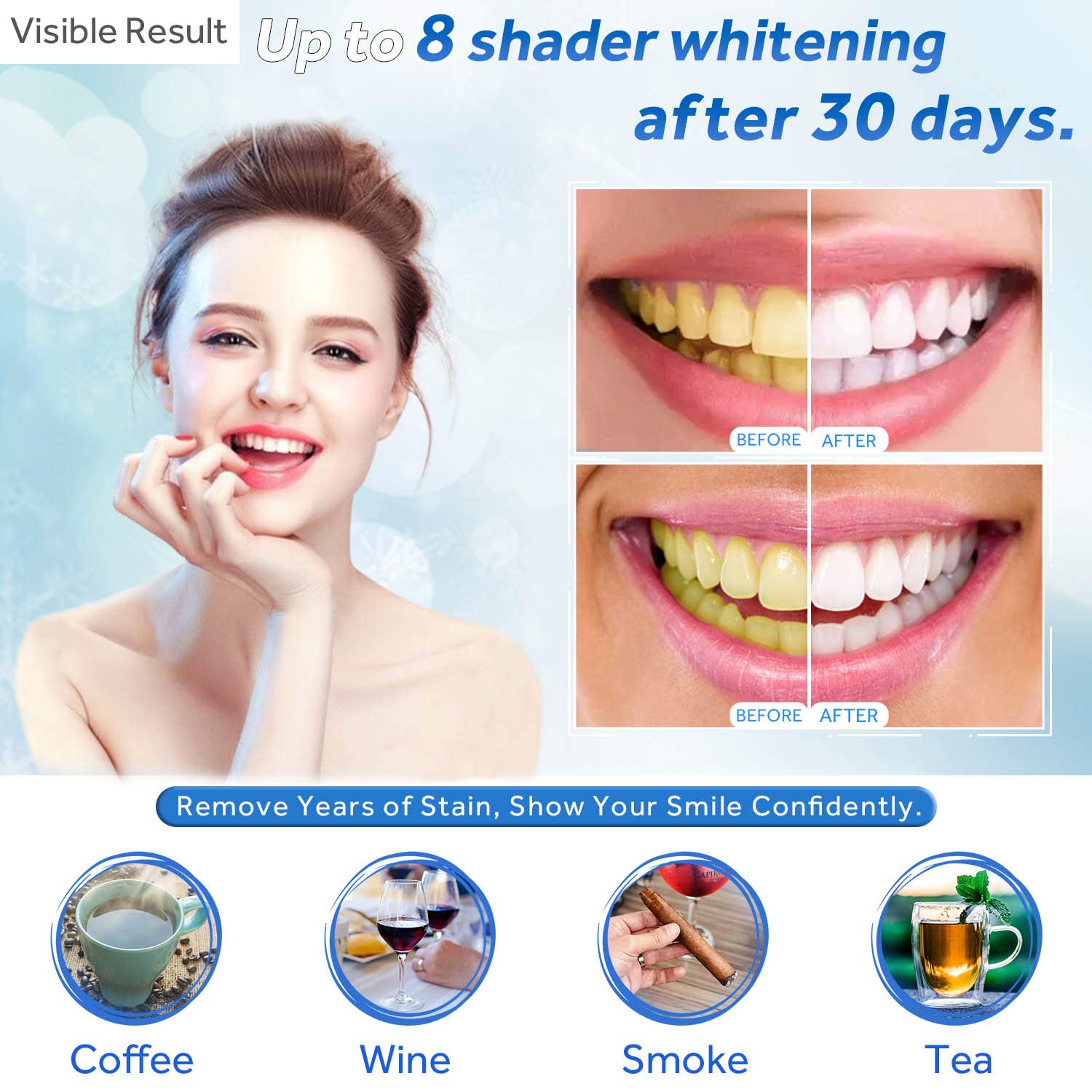 Teeth Whitening Gel Refill Syr - đánh giá và giá Teeth Whitening Bleaching Kit