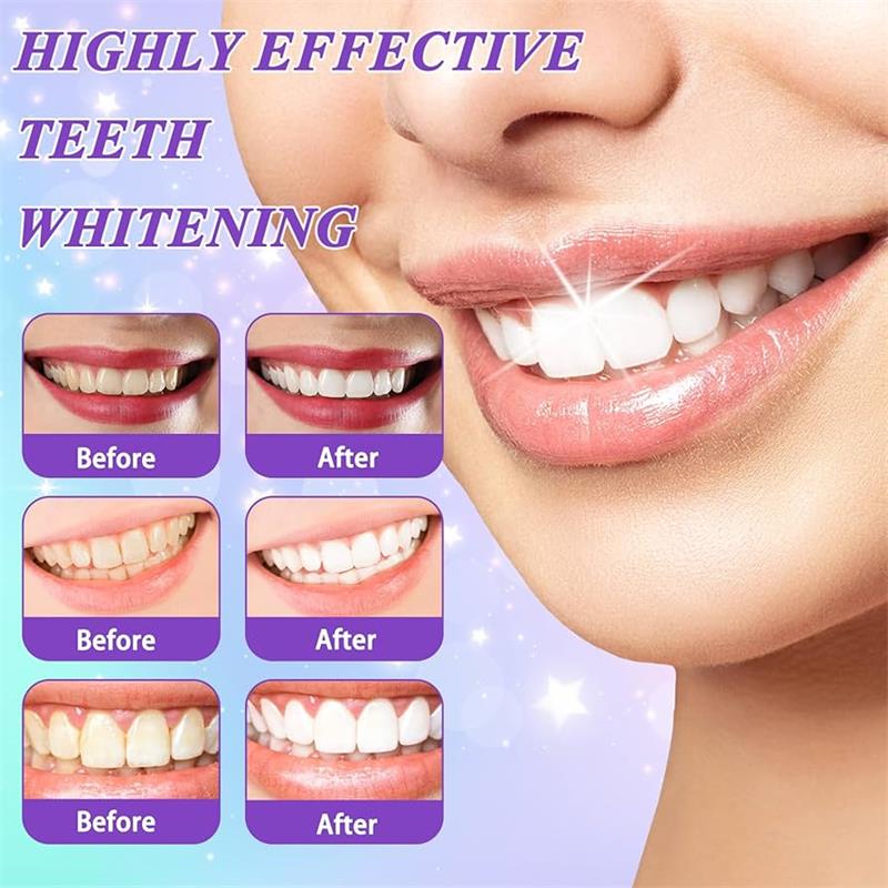 9D Purple Teeth Whitening Toot - đánh giá và giá Teeth Whitening Natural