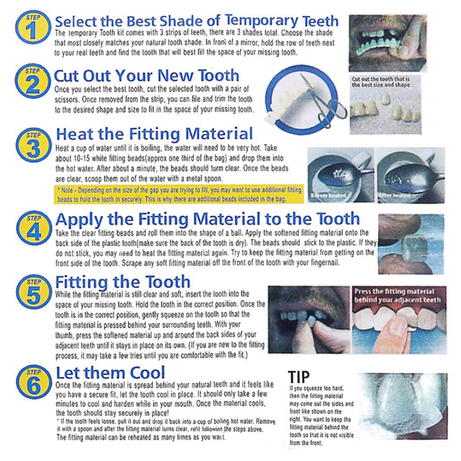 Temporary Teeth Whitening Kit  - đánh giá và giá Teeth Whitening At Home Kit
