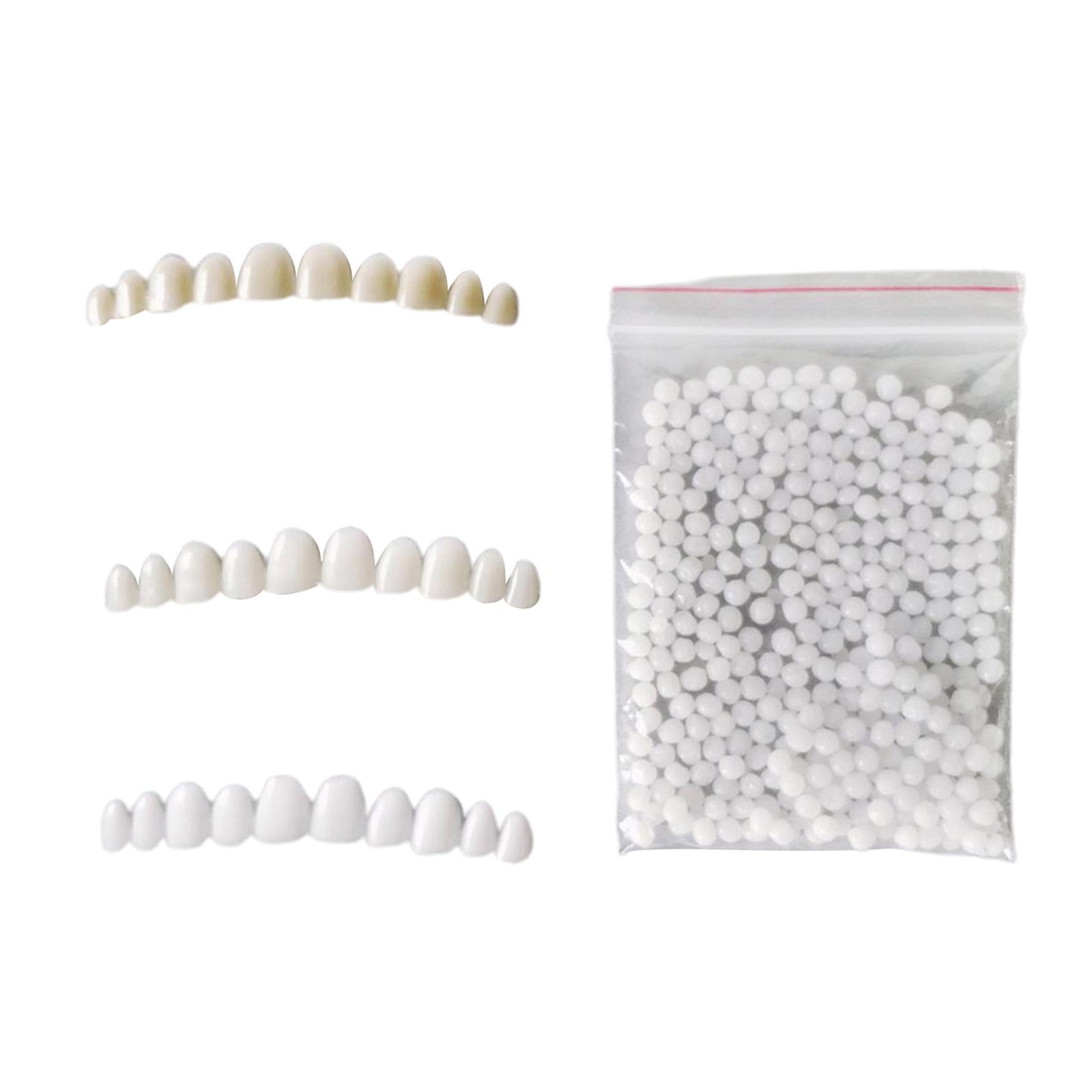 Temporary Teeth Whitening Kit  - đánh giá và giá Teeth Whitening At Home Kit