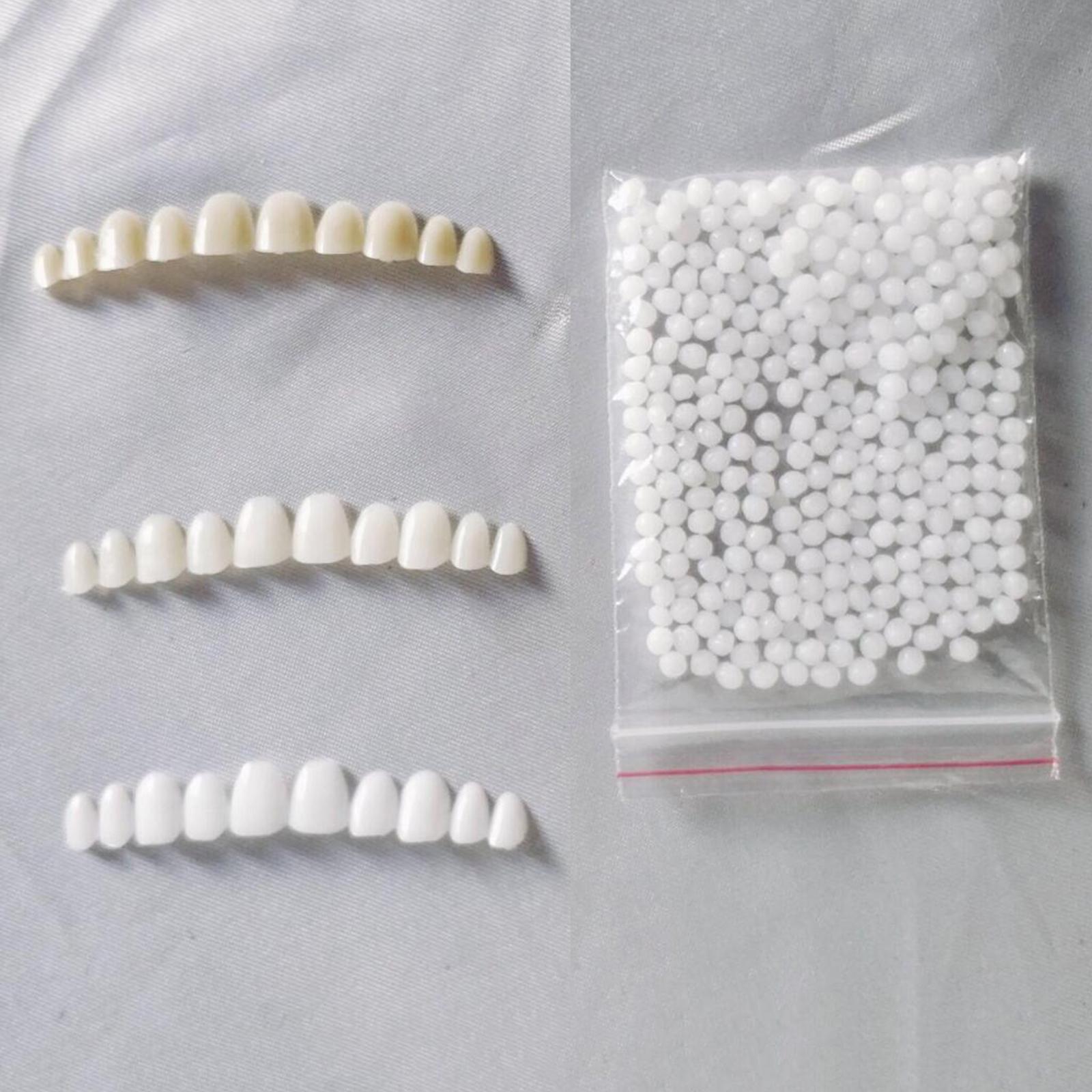 Temporary Teeth Whitening Kit  - đánh giá và giá Teeth Whitening At Home Kit