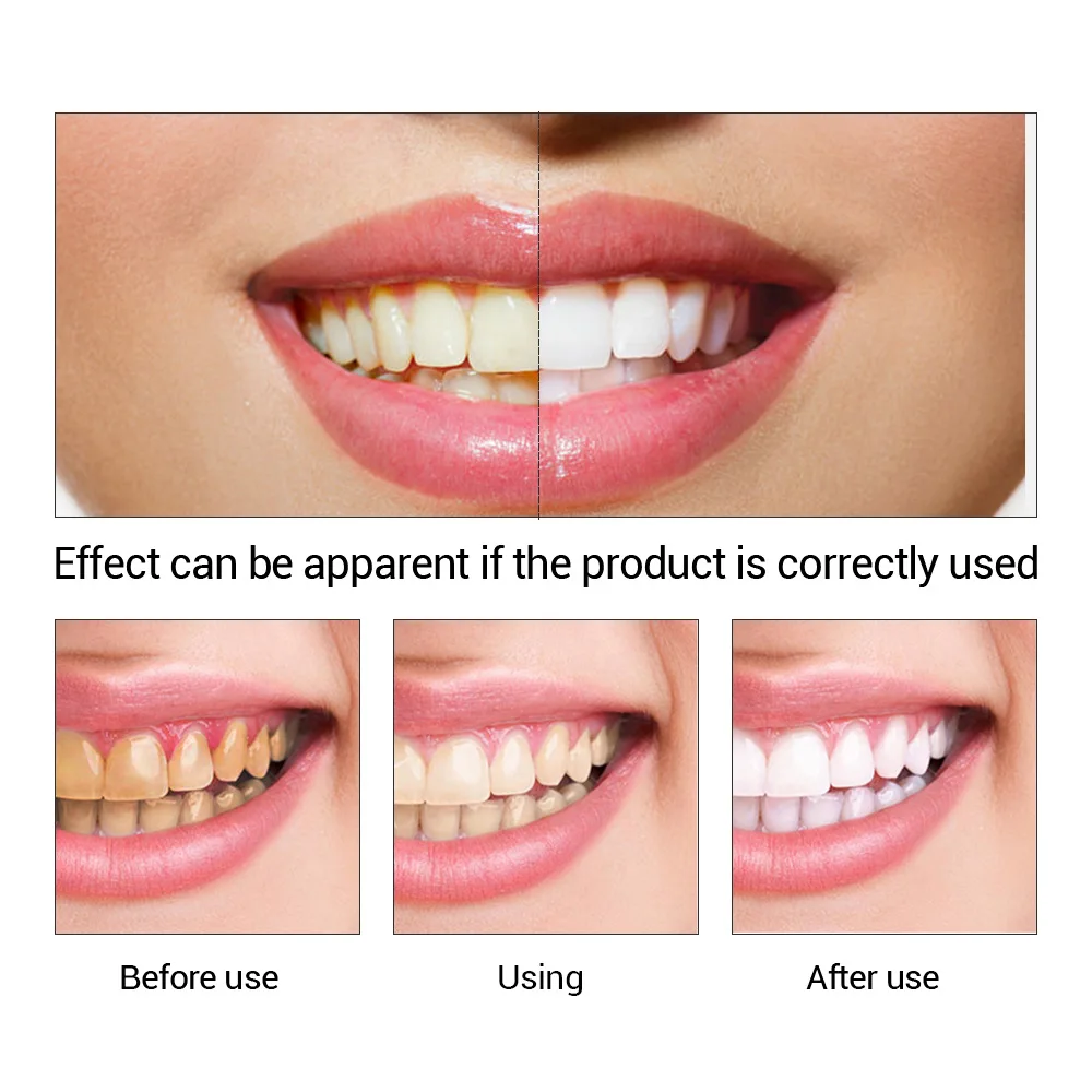 FTEENPLY Làm Trắng Răng Tinh C - đánh giá và giá Teeth Whitening Natural