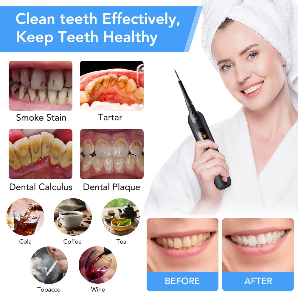 Electric Dental Scaler Toothbr - đánh giá và giá Teeth Whitening Or Tooth Whitening