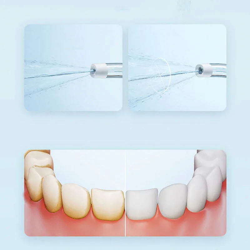 Xiaomi Portable Oral Irrigator - đánh giá và giá Teeth Whitening Or Tooth Whitening