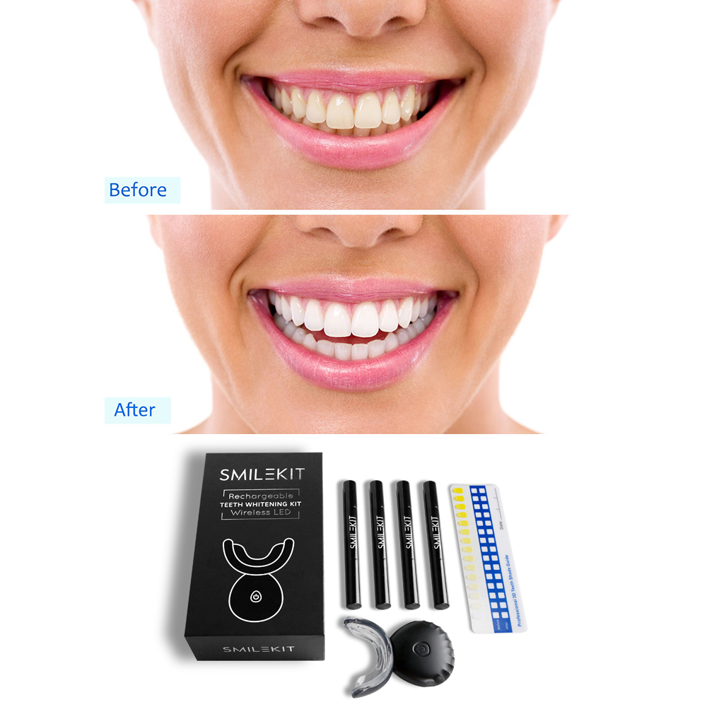 Điện Mới Làm Trắng Răng LED Sử - đánh giá và giá Teeth Whitening Bleaching Kit