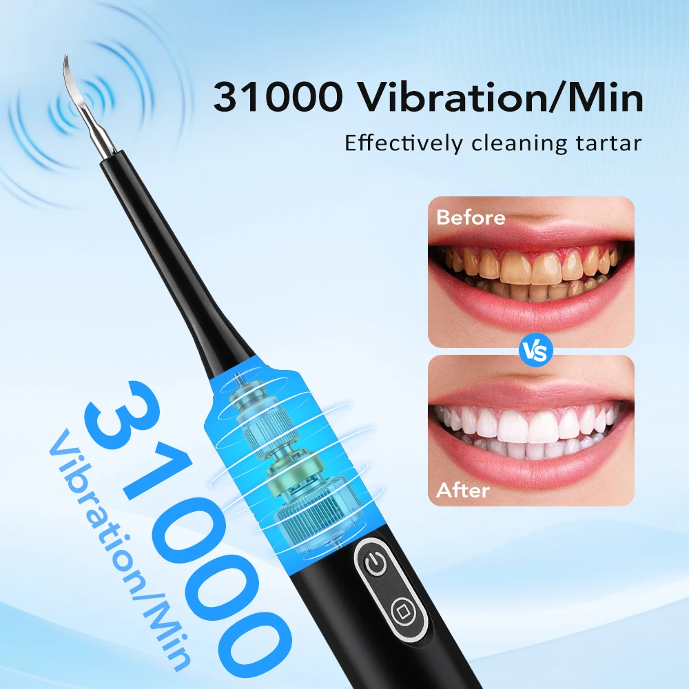 Electric Sonic Vibration Denta - đánh giá và giá Electric Toothbrush Sonic